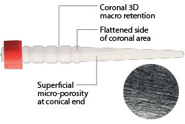 RelyX Fiber Post 3D Benefits