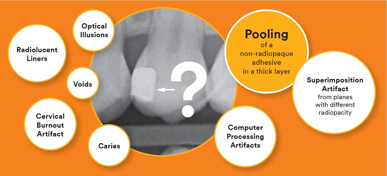 Informative oral care related imagery with a file name of 3M_Blog_04.png shown on Solventum's "Brain Floss" blog