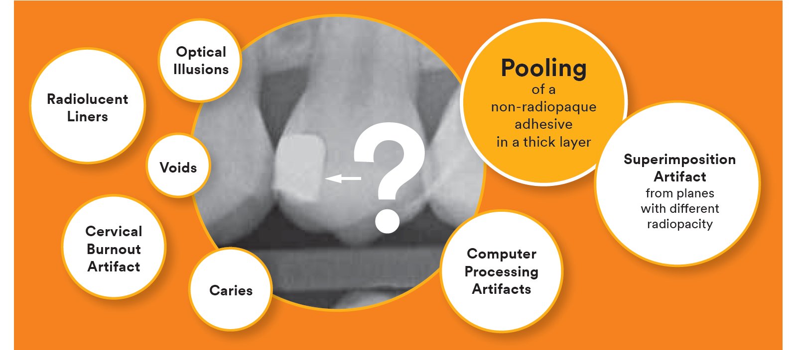 Informative oral care related imagery with a file name of 3M_Blog_04.png shown on Solventum's "Brain Floss" blog