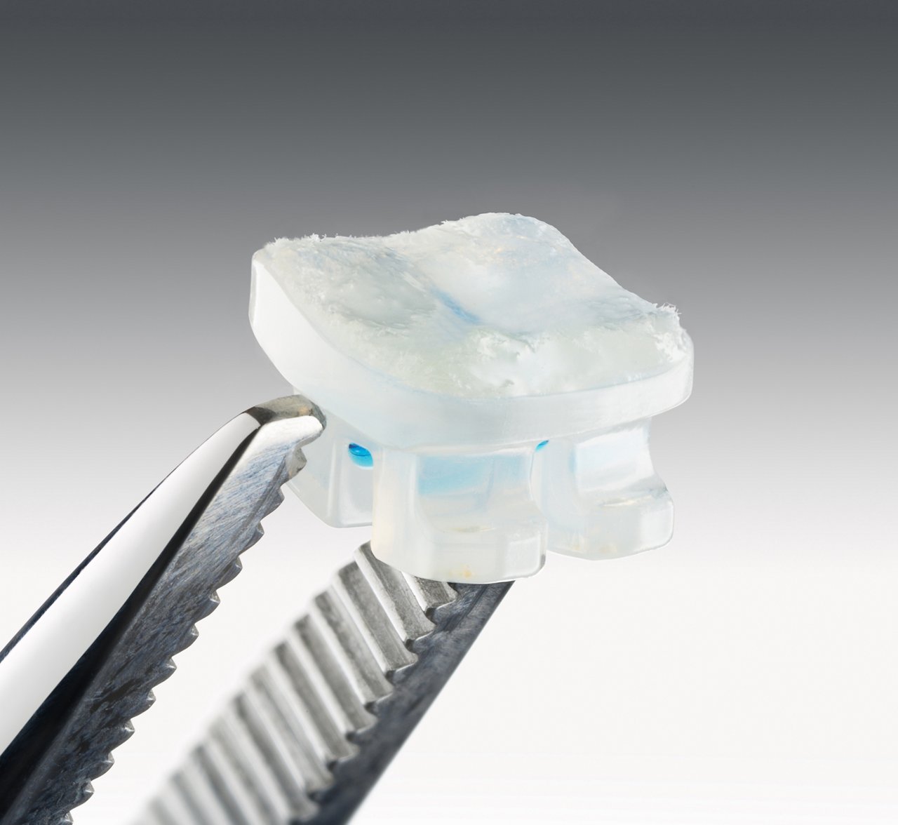 Extreme close-up 3M clarity advanced bracket met apc flash free adhesive