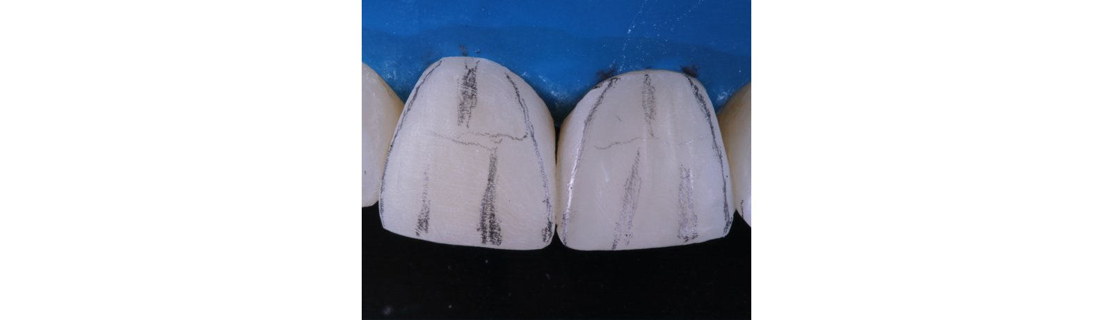 Application of adhesive