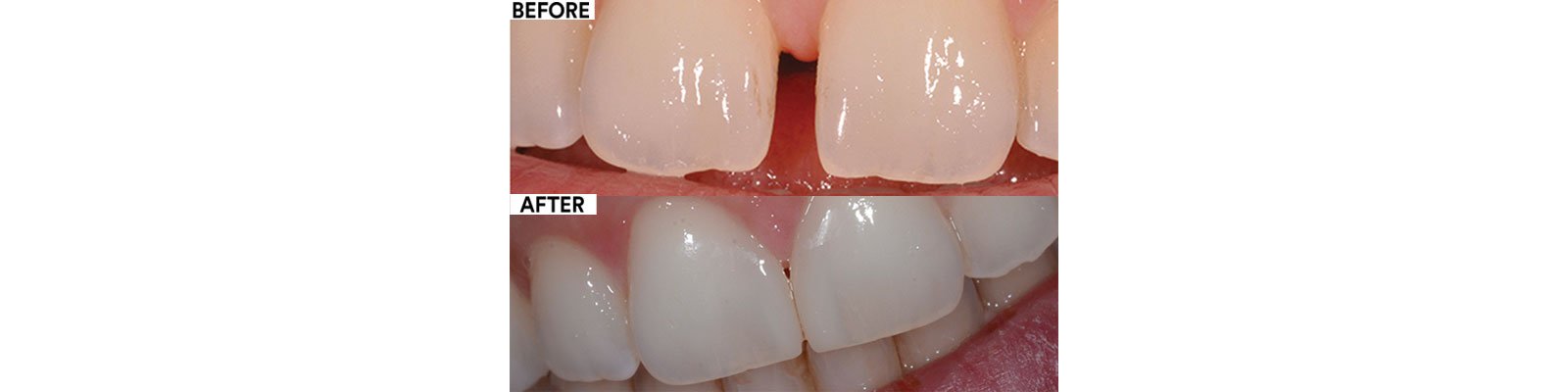 Informative oral care related imagery with a file name of 3M_Success_Simplified_FB_Ma-1.jpg shown on Solventum's "Brain Floss" blog