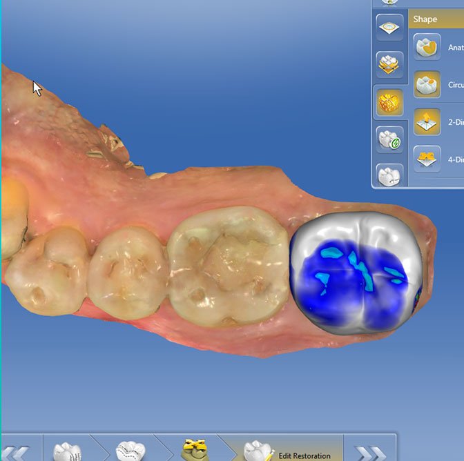 Proprosal with occlusion