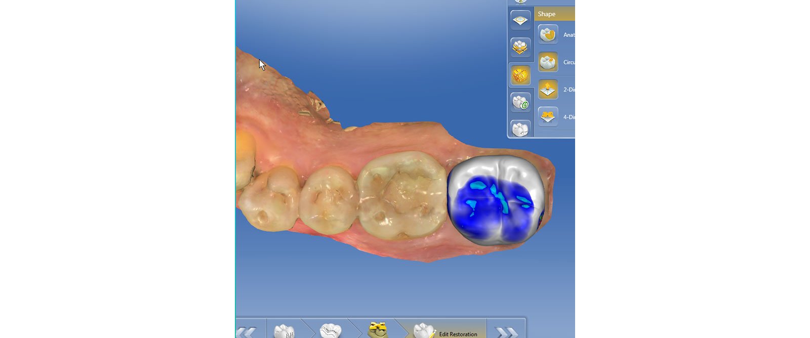 Proprosal with occlusion