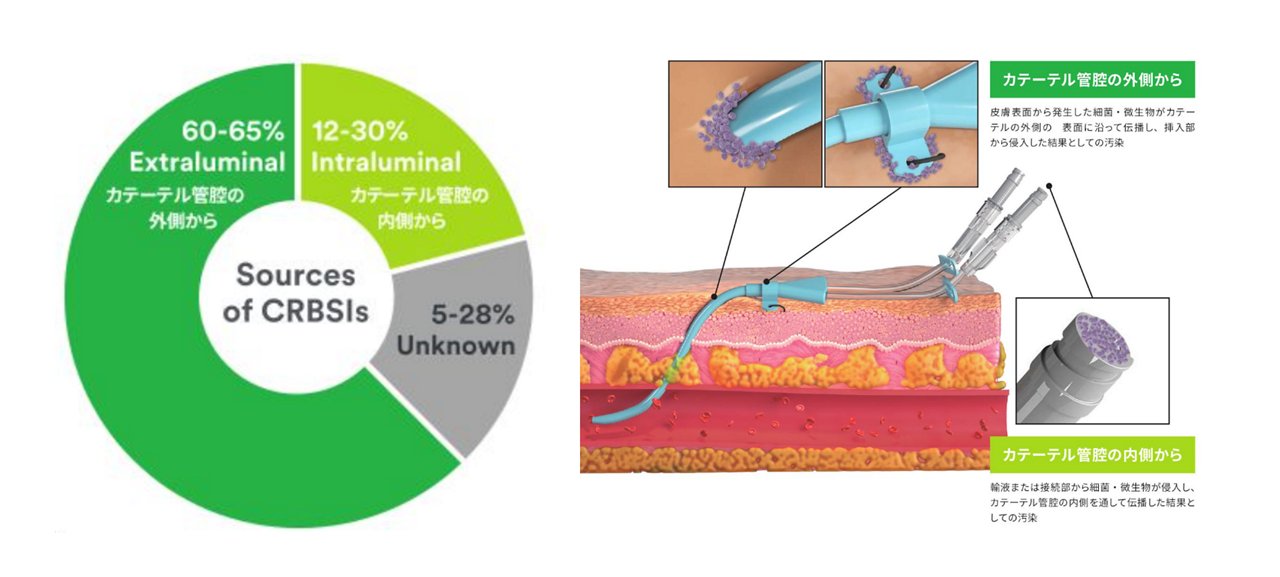 CRBSIの起因となる細菌や微生物は複数の汚染経路を持っており、カテーテル管腔の外側からの汚染と、カテーテル管腔の内側からの汚染に分けてそれぞれ対策が必要です。