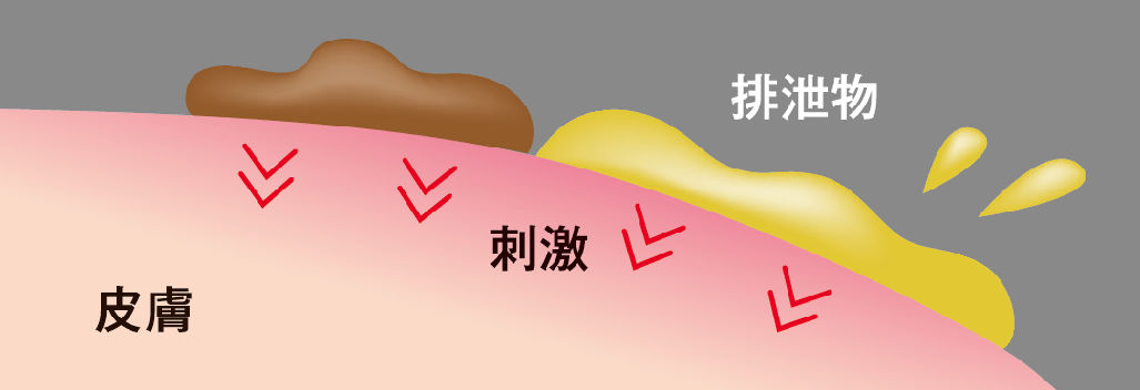 おしっこ・うんちとの接触