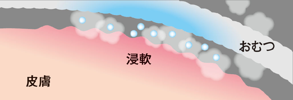 お肌のふやけ