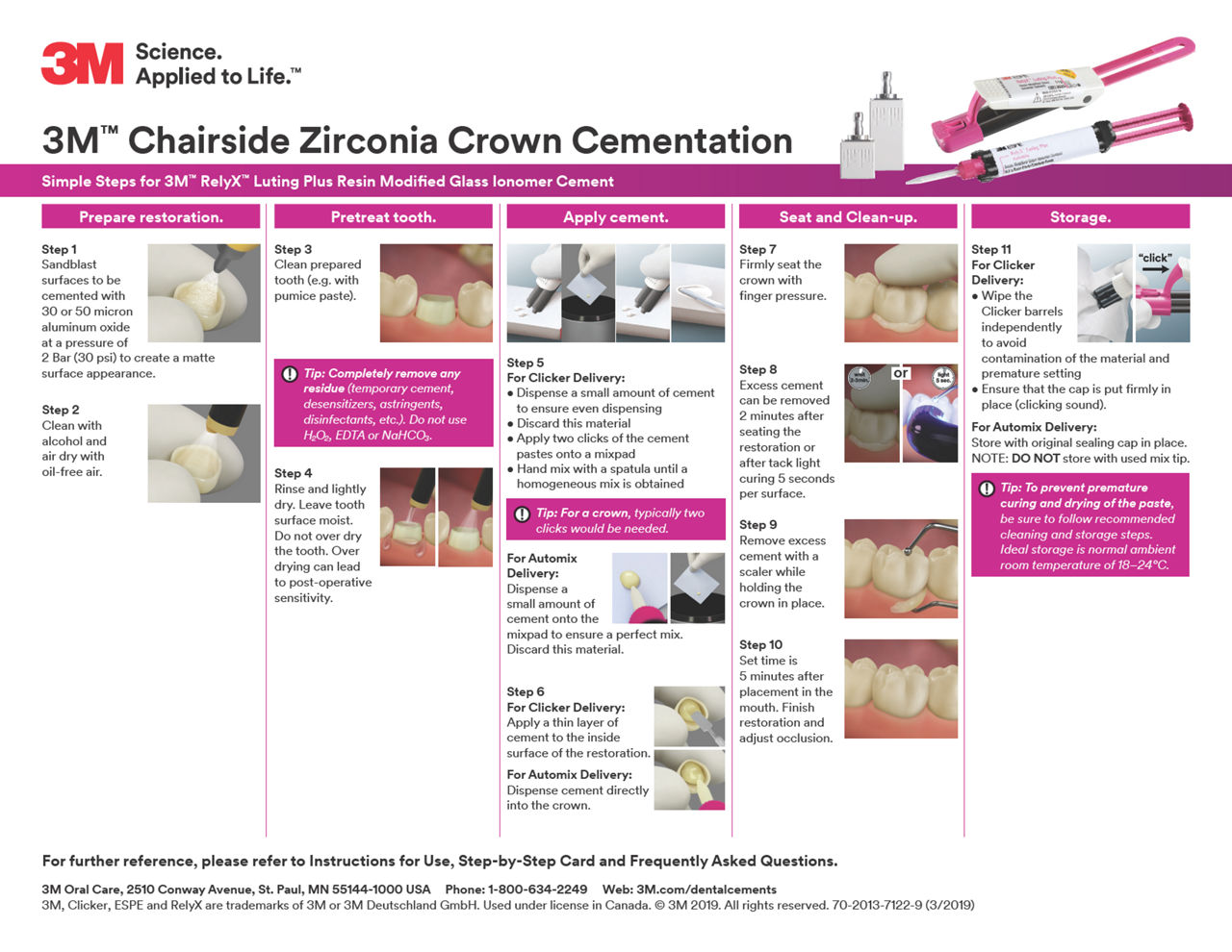 3M™ Chairside Zirconia Crown Cementation