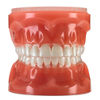 3M™ Typodont Clarity™ Ultra Self-Ligating Upper/Lower, 600-243, 1/Ea