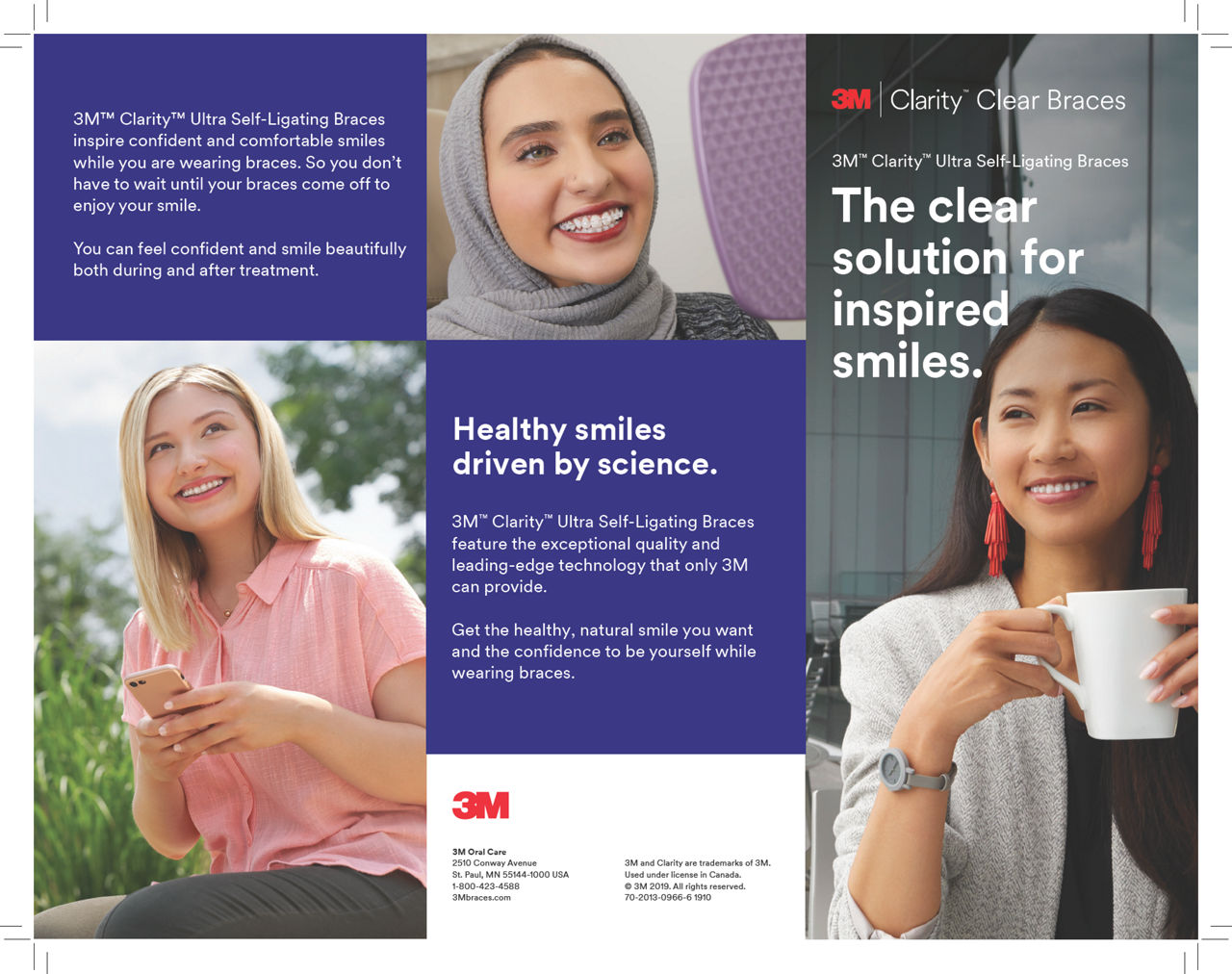 3M™ Clarity™ Ultra Self-Ligating Braces
