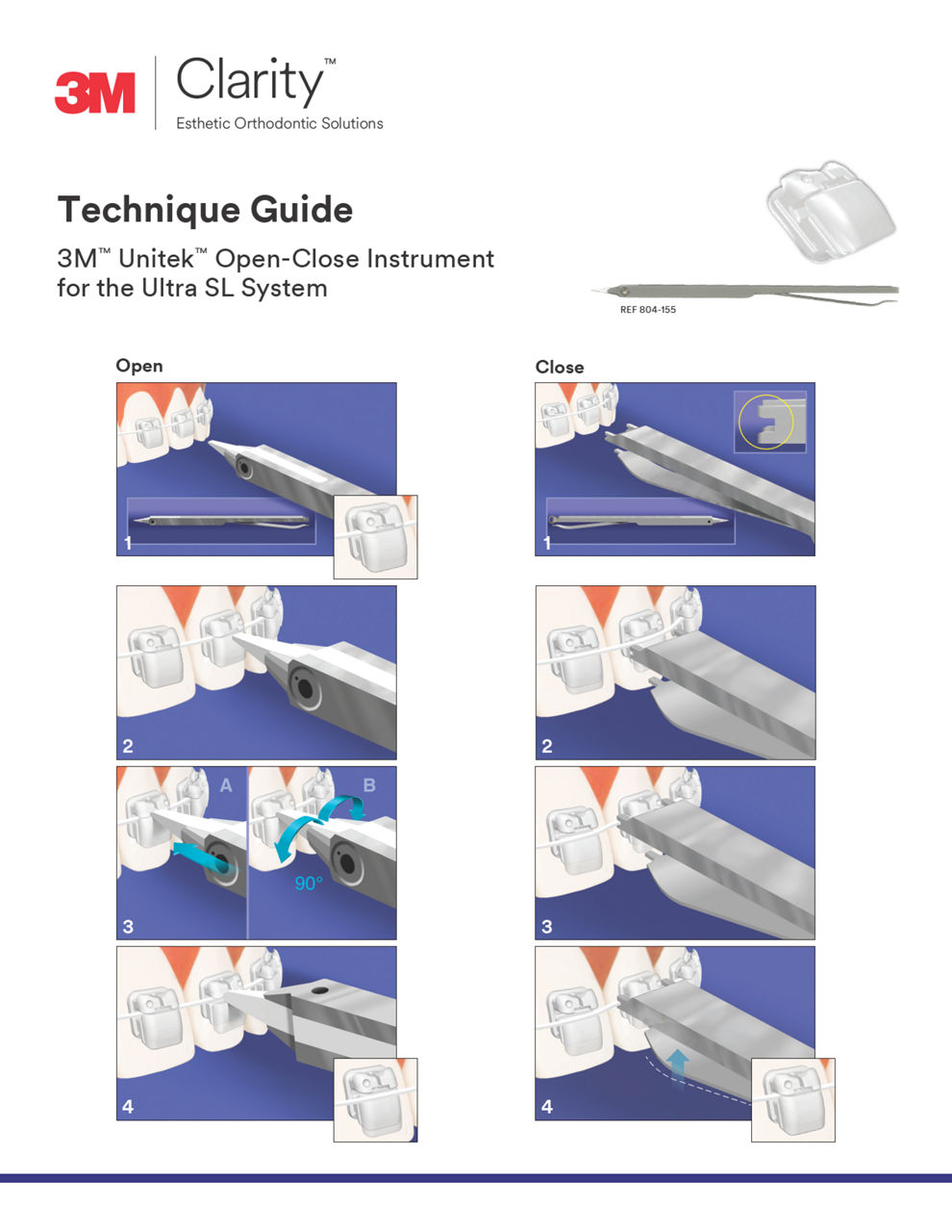 3M™ Clarity™ Ultra Technique Guide