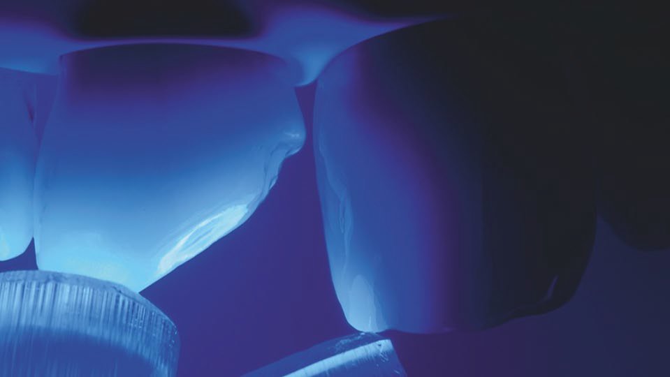 Light-curing teeth with 3M™ Elipar™ DeepCure-S LED Curing Light