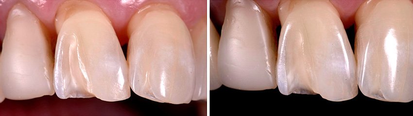 Informative oral care related imagery with a file name of image_2023_04_20T09_59_05_973Z.png shown on Solventum's "Brain Floss" blog