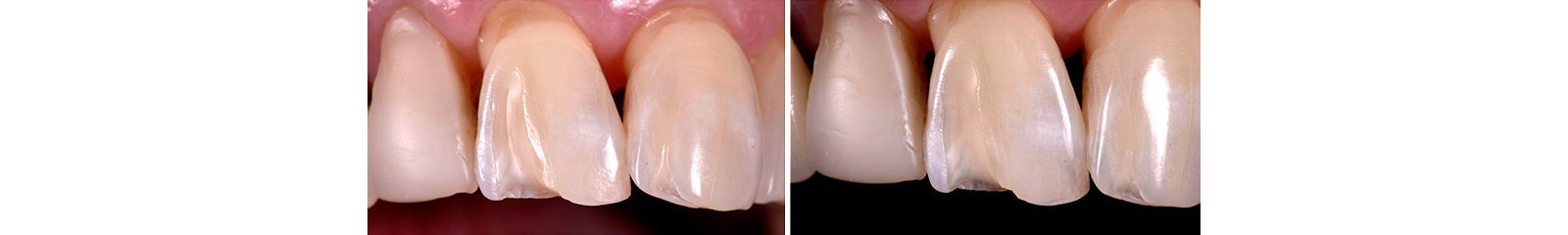 Informative oral care related imagery with a file name of image_2023_04_20T09_59_05_973Z.png shown on Solventum's "Brain Floss" blog