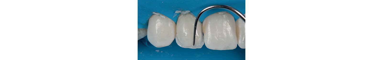 Informative oral care related imagery with a file name of IMG.015.jpeg shown on Solventum's "Brain Floss" blog