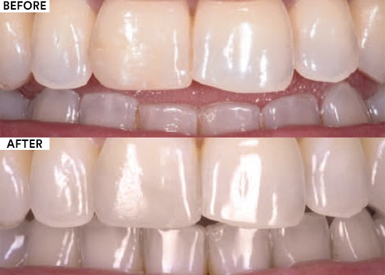 Informative oral care related imagery with a file name of IMG.021.jpeg shown on Solventum's "Brain Floss" blog