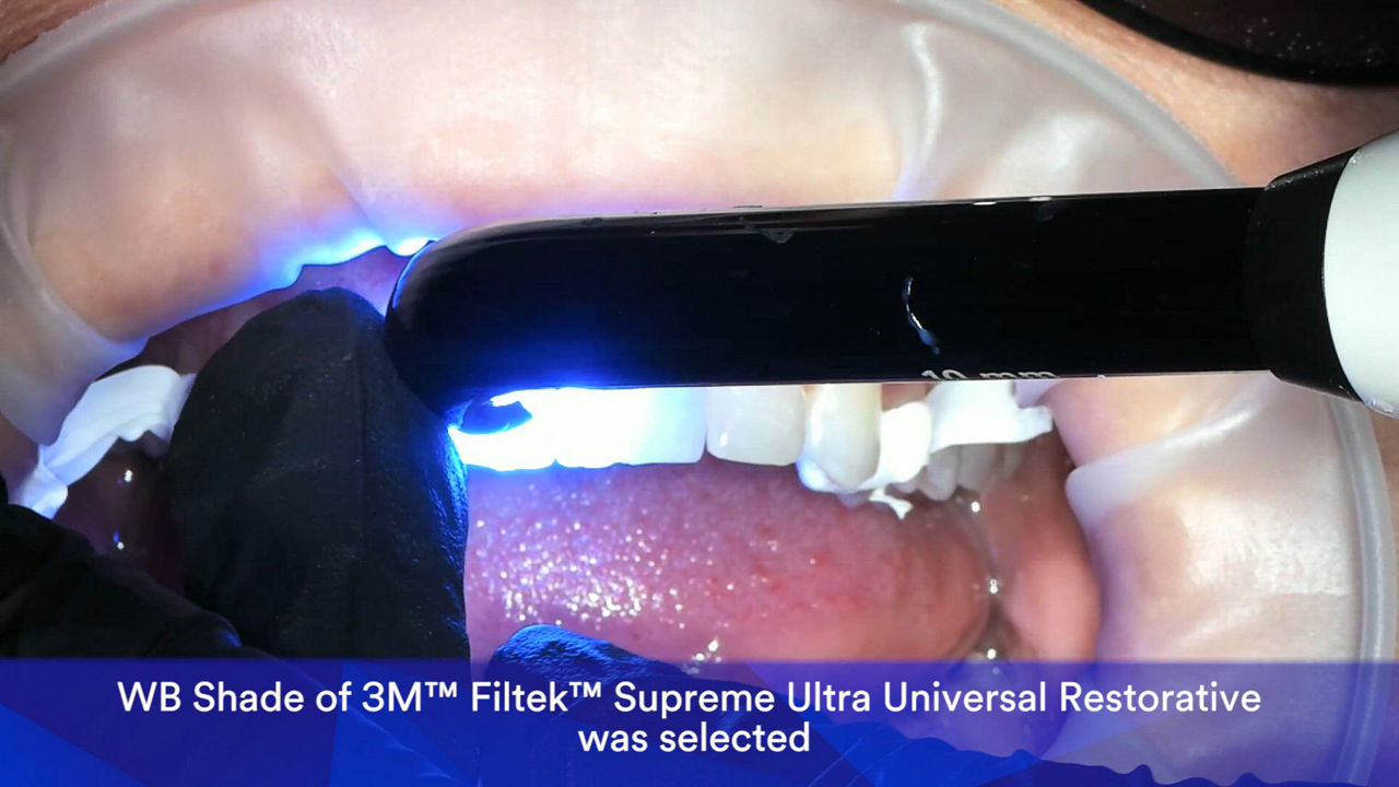 Dr-Sinclair_5-unit-Veneer-Case-1.mp4