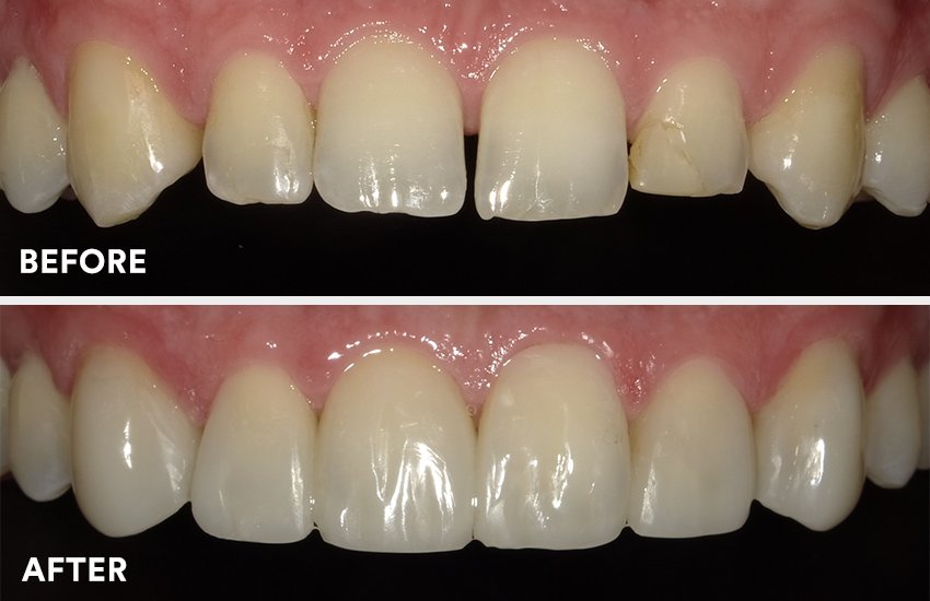 Informative oral care related imagery with a file name of 3M-Blog-2023_article-SI_Carlos-Villares_Essential-Lines.005.jpeg shown on Solventum's "Brain Floss" blog