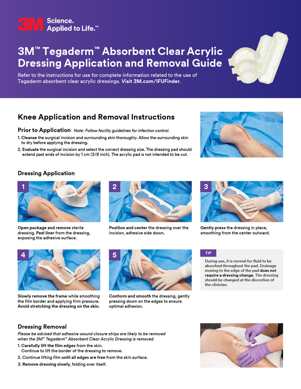 3M™ Tegaderm™ Absorbent Clear Acrylic Dressing Application and Removal Guide 