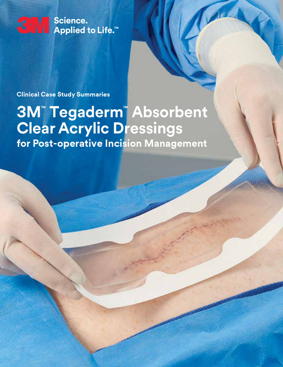 3M™ Tegaderm™ Absorbent Clear Acrylic Dressing Clinical Case Summary