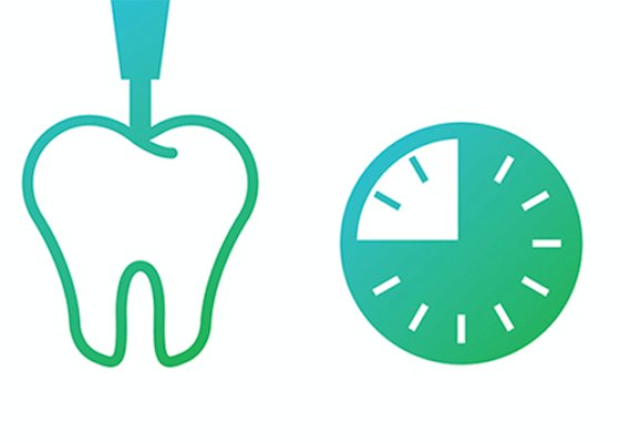 Image of a tooth being filled with composite and a clock