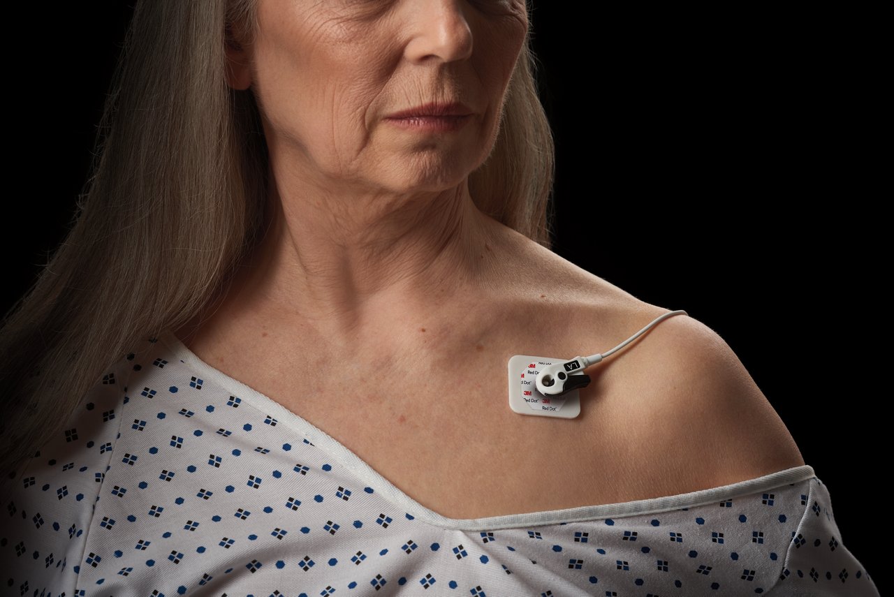 Patiente avec Plaques électro chirurgicales et Electrodes ECG 3M Rouge Dot BME 2