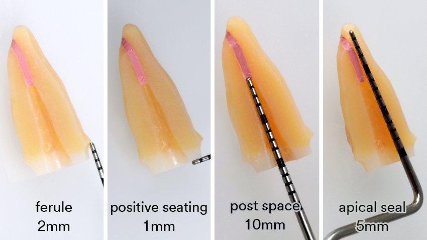 Informative oral care related imagery with a file name of 3M-BRAIN-FLOSS_SI-article_TOSCO_ESSENTIAL_IMG.014.jpeg shown on Solventum's "Brain Floss" blog