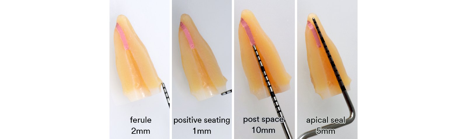 Informative oral care related imagery with a file name of 3M-BRAIN-FLOSS_SI-article_TOSCO_ESSENTIAL_IMG.014.jpeg shown on Solventum's "Brain Floss" blog