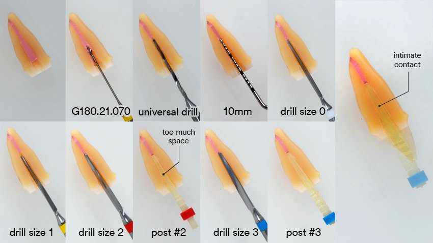 Informative oral care related imagery with a file name of 3M-BRAIN-FLOSS_SI-article_TOSCO_ESSENTIAL_IMG.015.jpeg shown on Solventum's "Brain Floss" blog