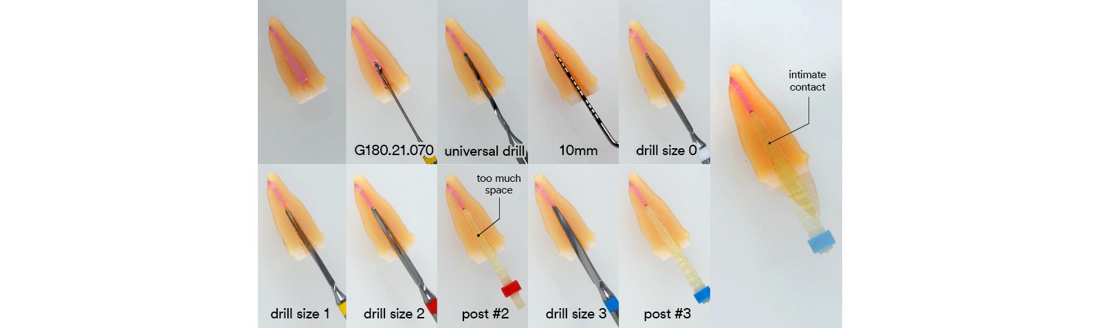 Informative oral care related imagery with a file name of 3M-BRAIN-FLOSS_SI-article_TOSCO_ESSENTIAL_IMG.015.jpeg shown on Solventum's "Brain Floss" blog