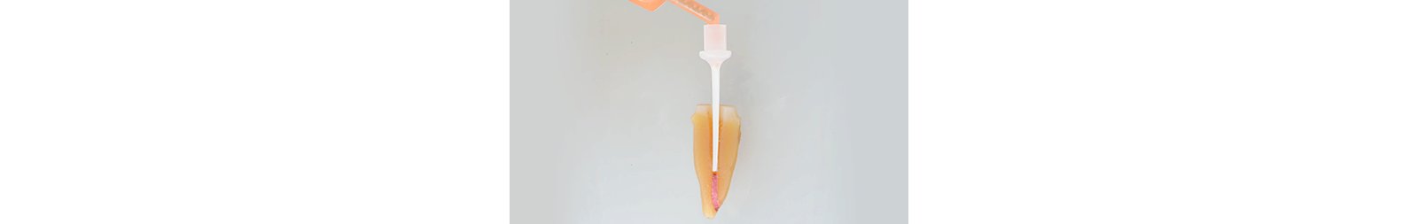 Informative oral care related imagery with a file name of 3M-OC-Blog-Event-Teaser.png shown on Solventum's "Brain Floss" blog