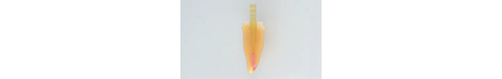 Informative oral care related imagery with a file name of IMPSQ_CC_Replace_SUMC_Reich_Hero.jpg shown on Solventum's "Brain Floss" blog