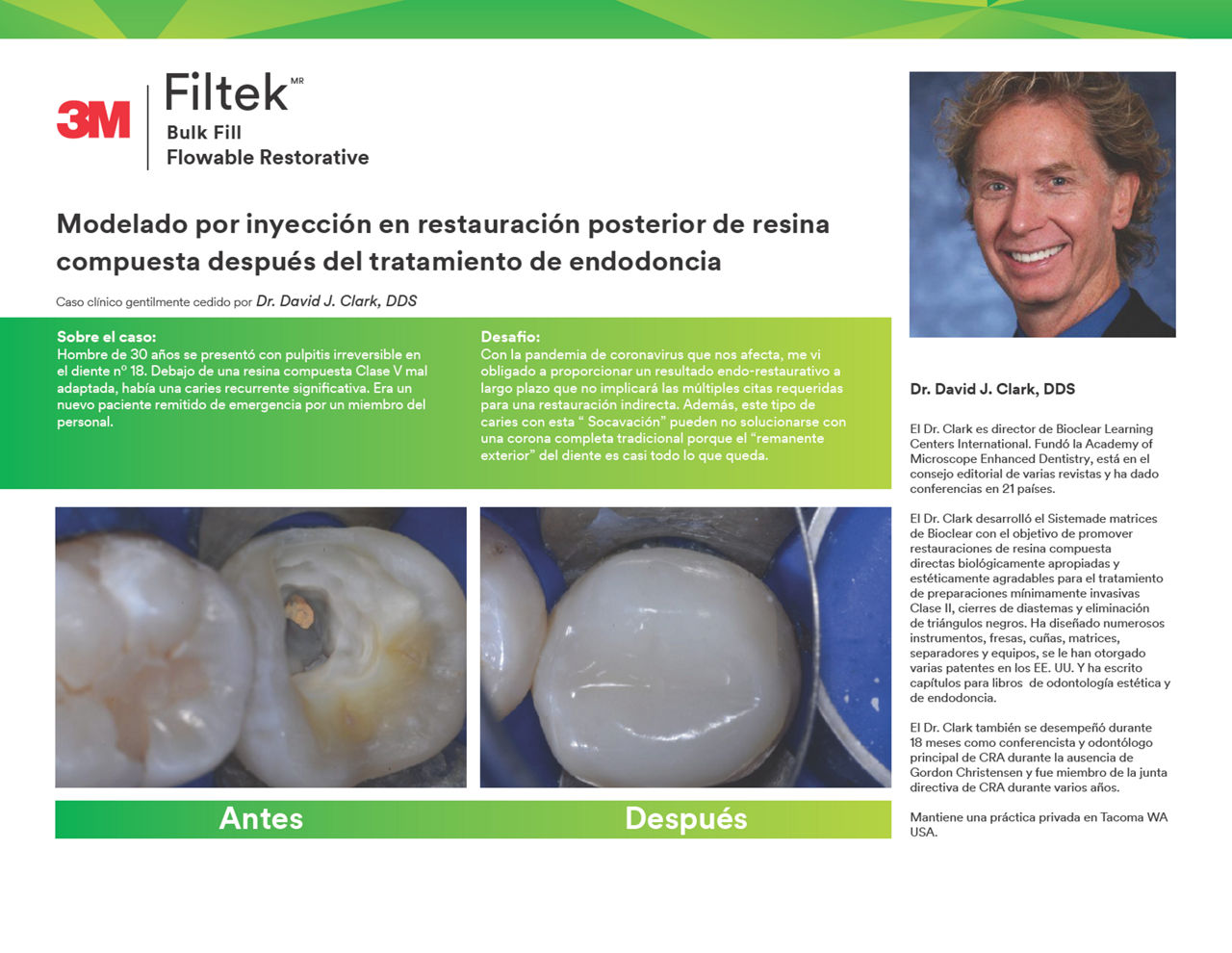 3M™ Filtek™ Bulk Fill Flowable Restorative Dr.Clark, Caso Clínico Español