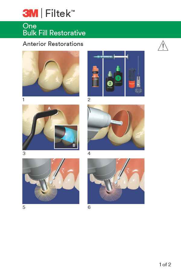 One Bulk Fill Restorative