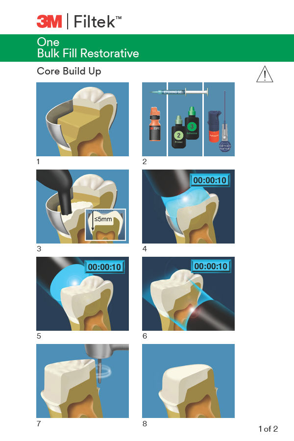 3M™ Filtek™ One Bulk Fill Restorative Core Build Up