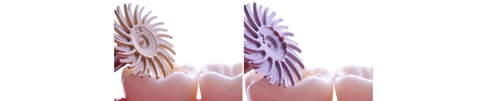 Informative oral care related imagery with a file name of 3MOCSD_Blog_Round13_Arcara_RelyXUniversal_560x460_11.jpg shown on Solventum's "Brain Floss" blog