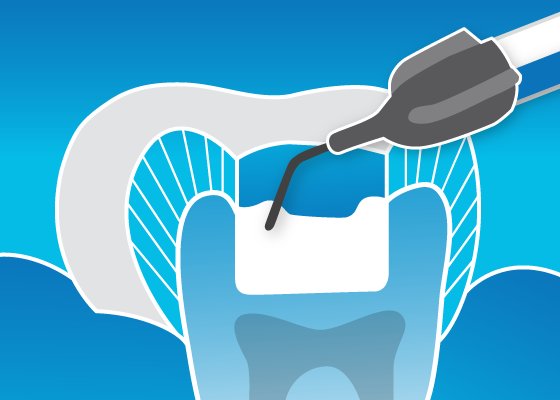 Informative oral care related imagery with a file name of ClinicalCase_560x400.jpg shown on Solventum's "Brain Floss" blog