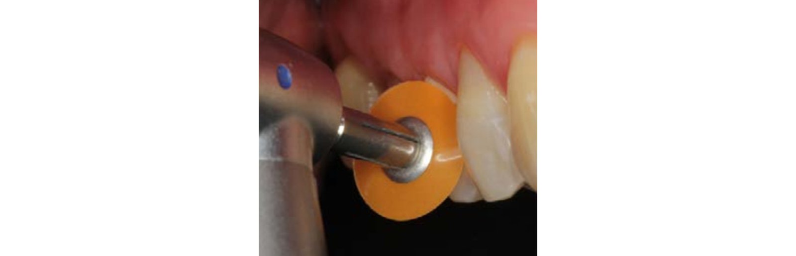 Finishing with contouring and polishing disc