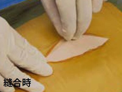 HPM_644_E_Ioban_howto_1_410_295