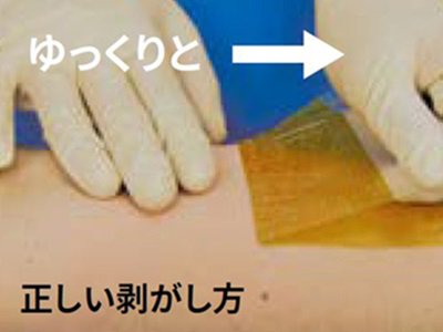 HPM_644_E_Ioban_howto_2_410_295