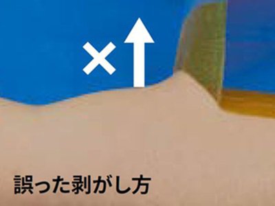 HPM_644_E_Ioban_howto_3_410_295