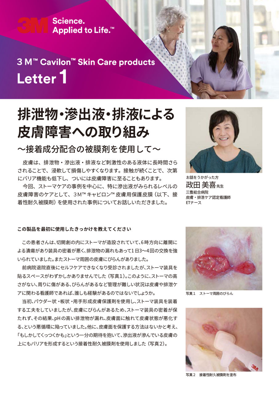 キャビロン 接着性耐久被膜 血管アクセス保護フライヤーカバープレビュー