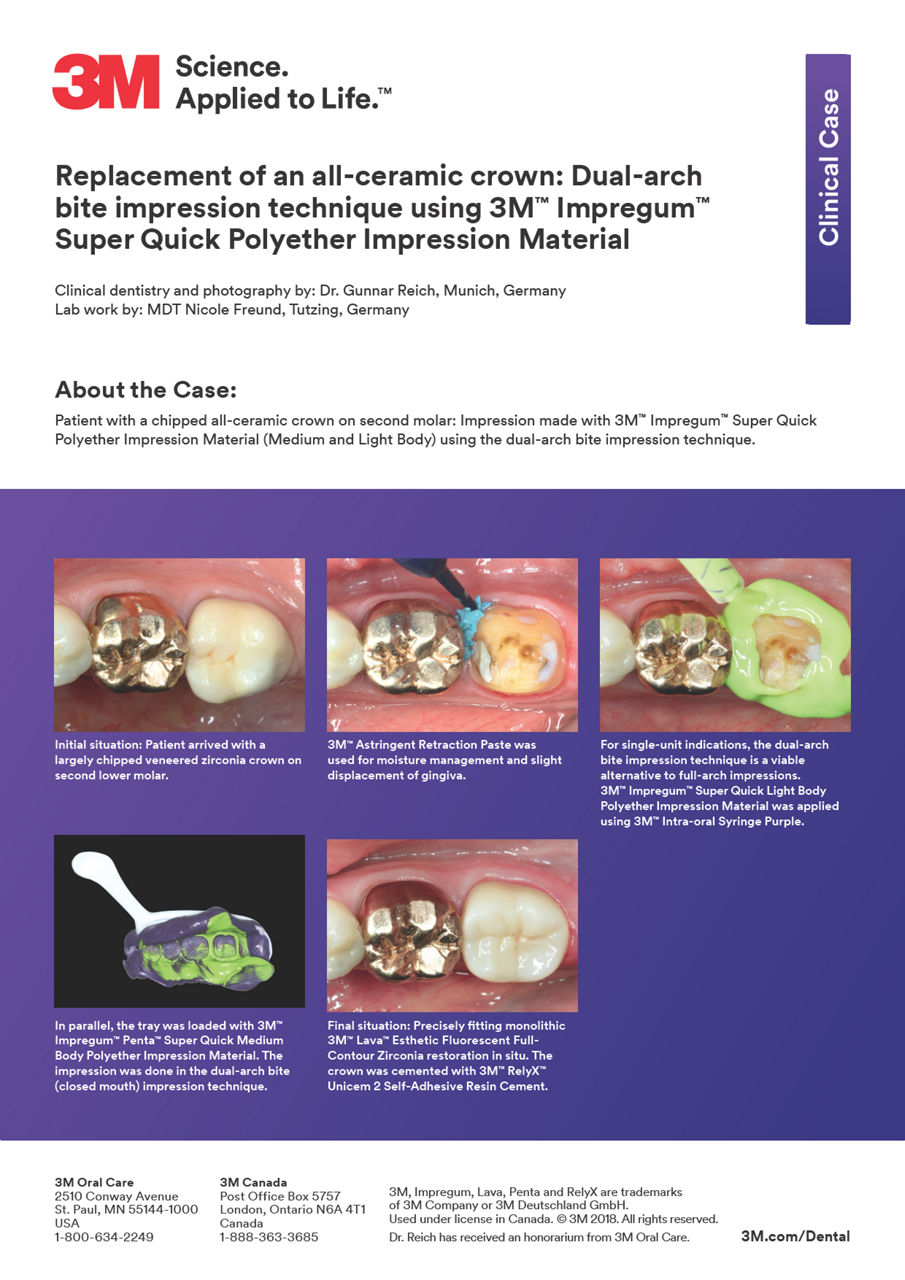 3M™ Impregum™ Super Quick Clinical Case "Replacement of an all-ceramic crown"