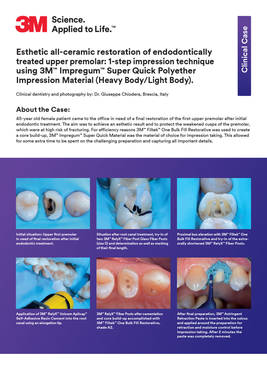 3M™ Impregum™ Super Quick Polyether Impression Material composite restoration, Clinical Case