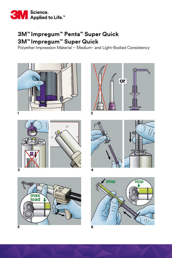 3M™ Impregum™ Penta™ Super Quick, - Super Quick Polyether Impression Material Step-by-Step Card