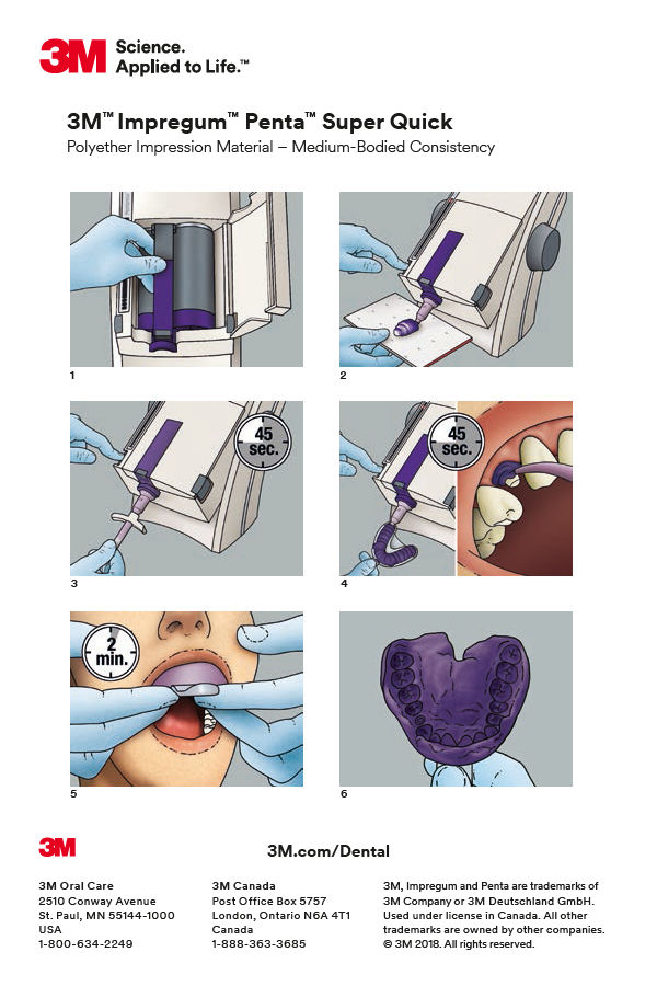 3M™ Impregum™ Penta™ Super Quick Polyether Impression Material Step-by-Step Card