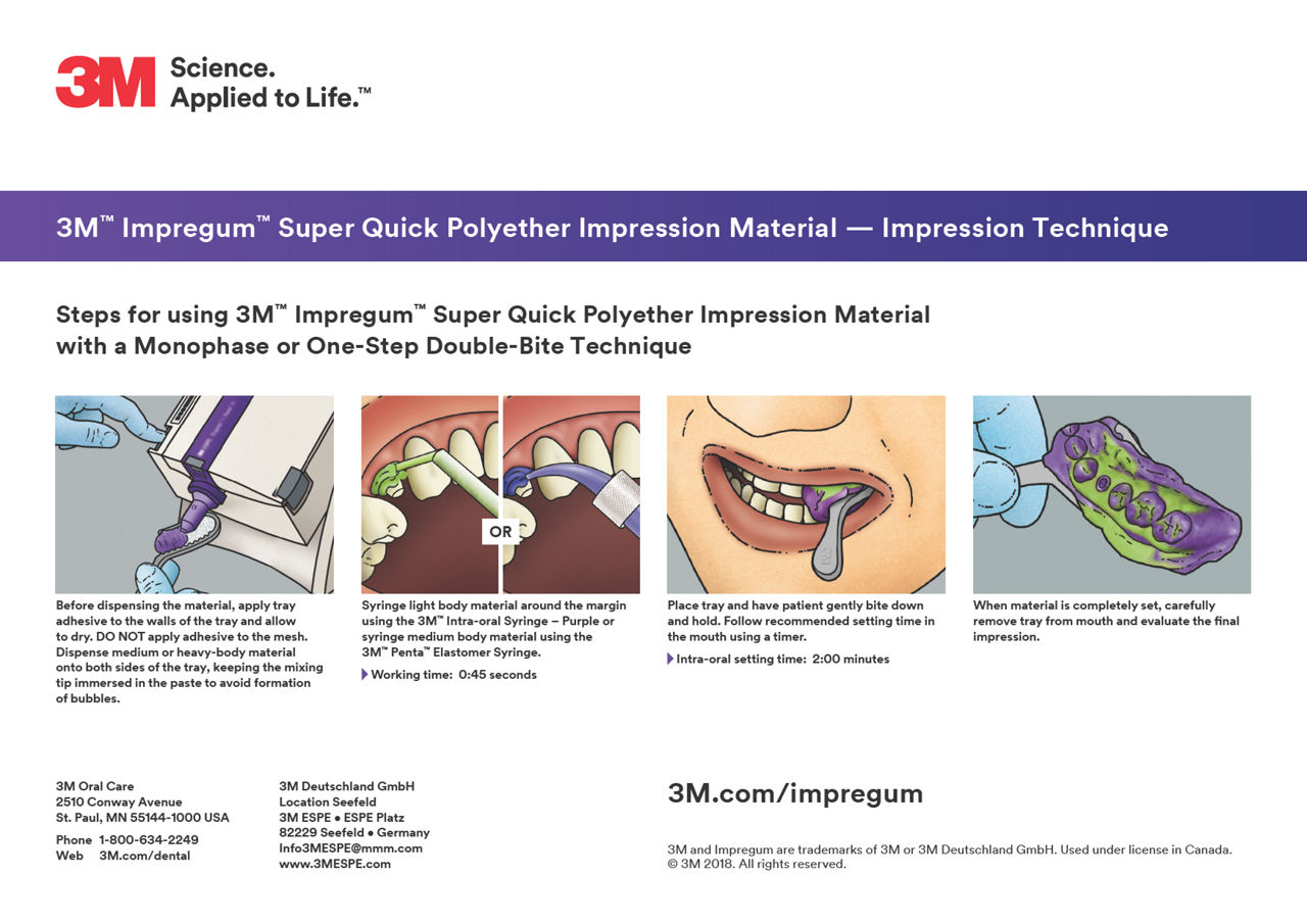 3M™ Impregum™ SQ Technique guide