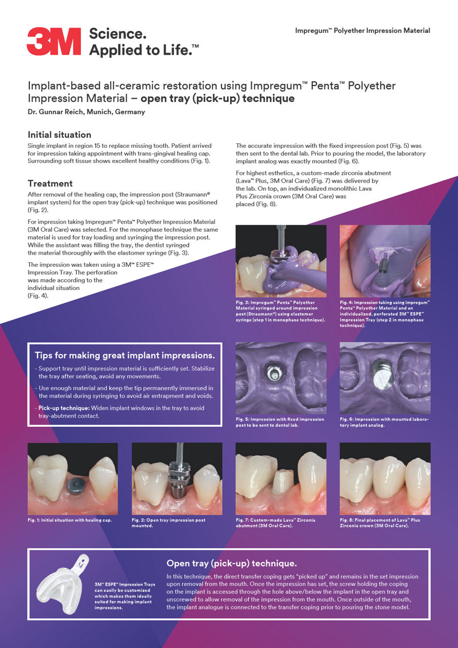 Impregum, Implant Clinical Cases, Int.