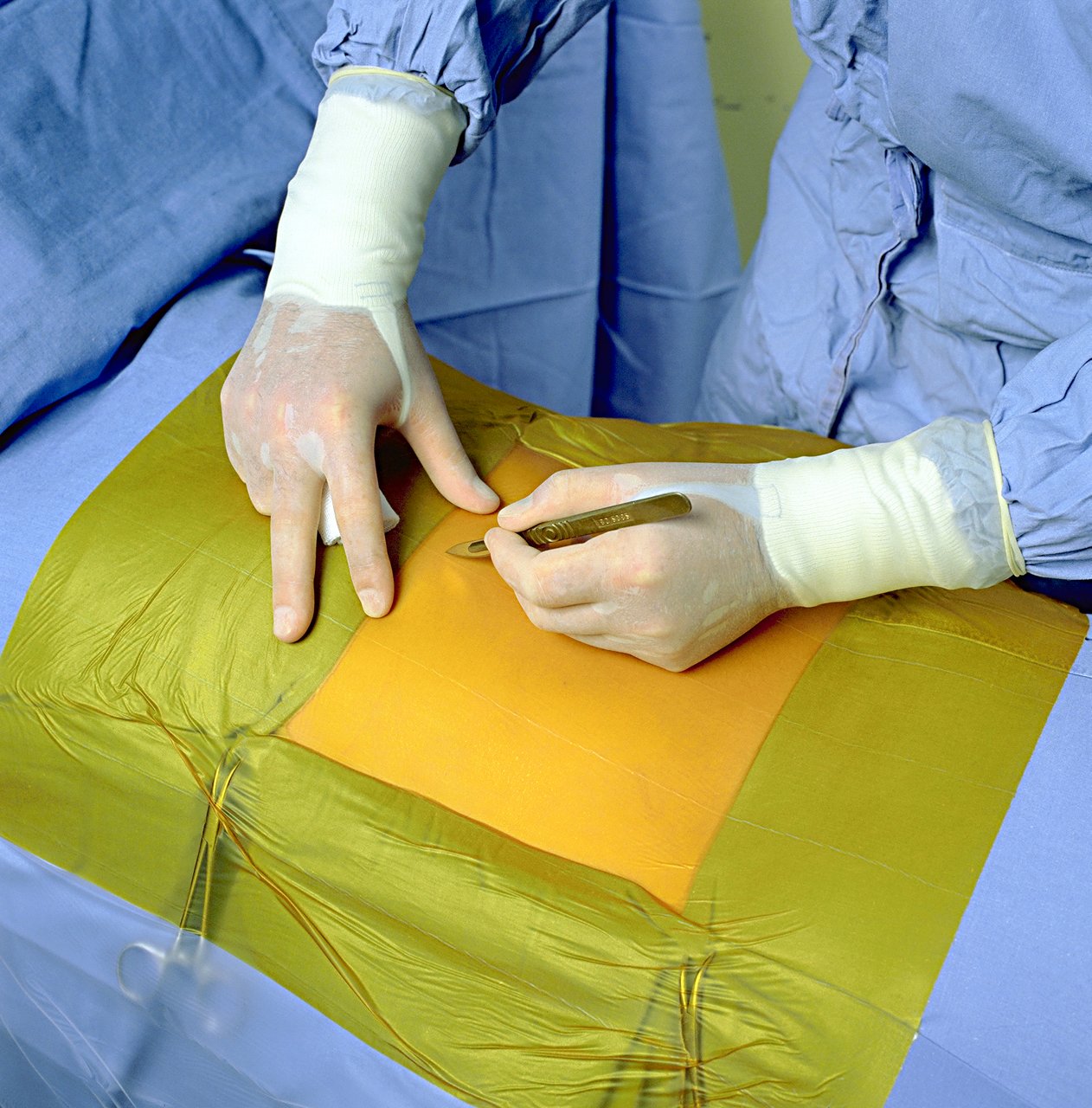 3M Ioban 2 Antimikrobielle Film-Inzisen Abdecktücher, Applikation, Tuch, chirurgische Abdeckungen, mit Iodophor imprägnierter Adhäsiv, anpassungsfähig, Chirurgie, Asepsis Produkte, Operationssaal, Chirurg, 6635, 6640, 6648, 6650, 6651, FR7023