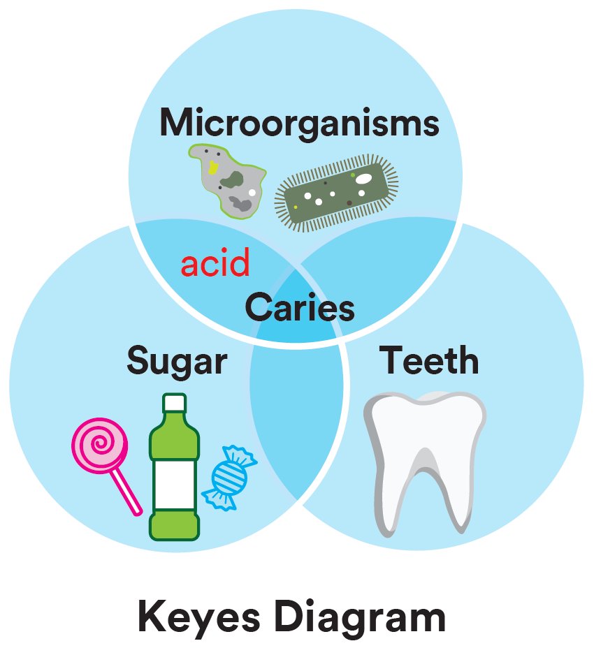 Informative oral care related imagery with a file name of magic-mix_11.jpg shown on Solventum's "Brain Floss" blog